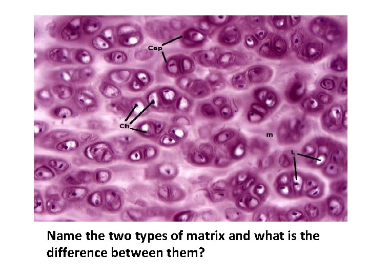 Name the two types of matrix and what is the difference between them? 