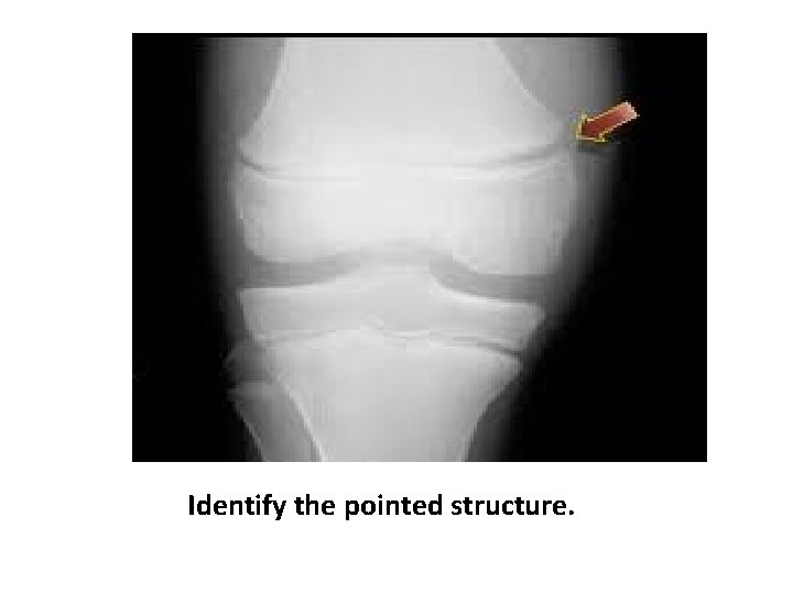 Identify the pointed structure. 