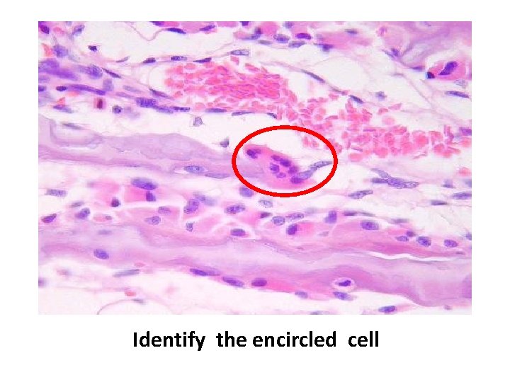Identify the encircled cell 