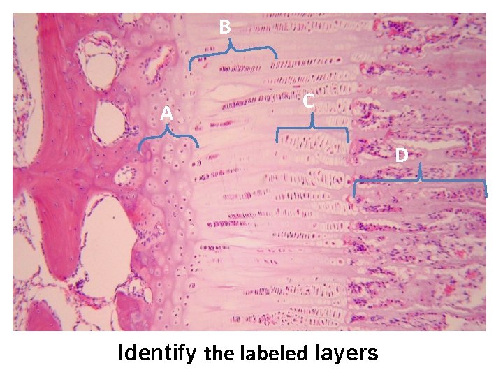 B A C D Identify the labeled layers 