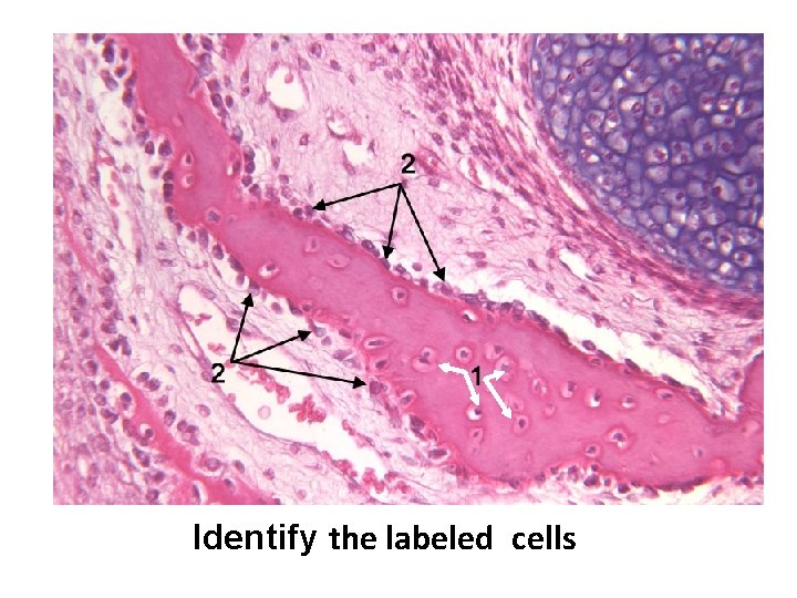 Identify the labeled cells 
