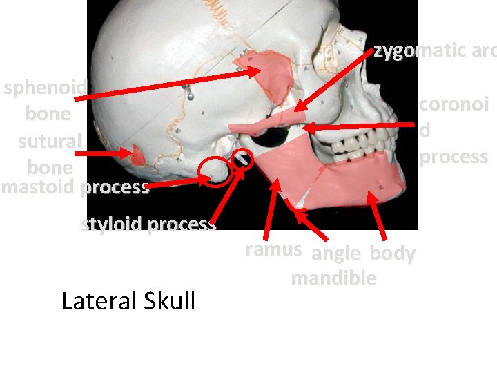 zygomatic arc sphenoid bone sutural bone mastoid process styloid process Lateral Skull coronoi d