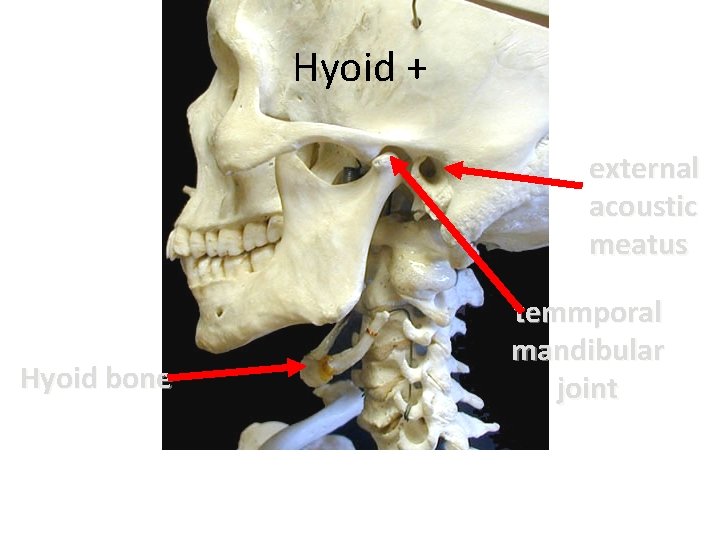 Hyoid + external acoustic meatus Hyoid bone temmporal mandibular joint 