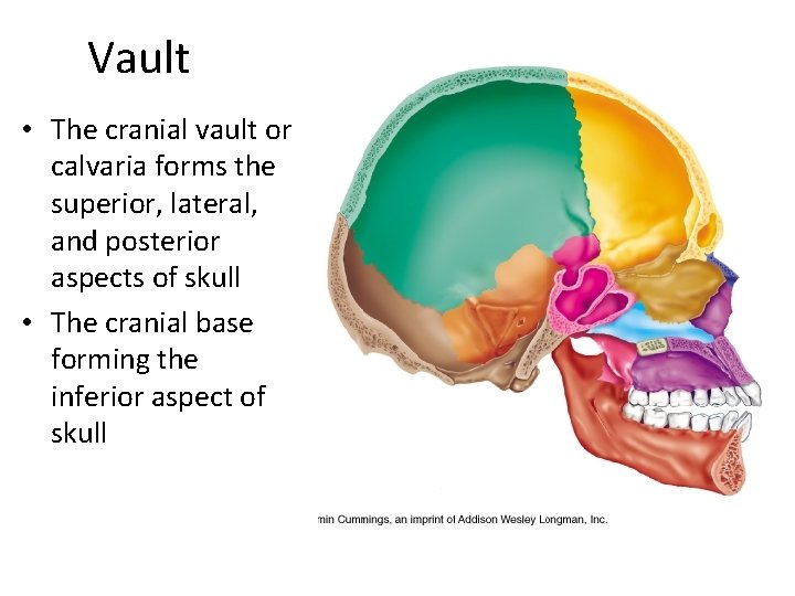 Vault • The cranial vault or calvaria forms the superior, lateral, and posterior aspects