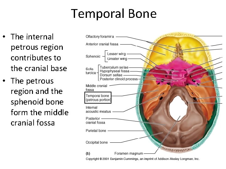 Temporal Bone • The internal petrous region contributes to the cranial base • The