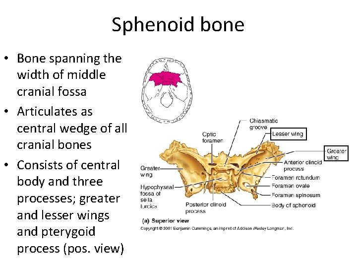 Sphenoid bone • Bone spanning the width of middle cranial fossa • Articulates as