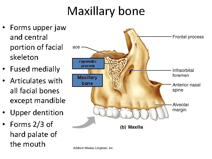 Maxillary bone • Forms upper jaw and central portion of facial skeleton • Fused