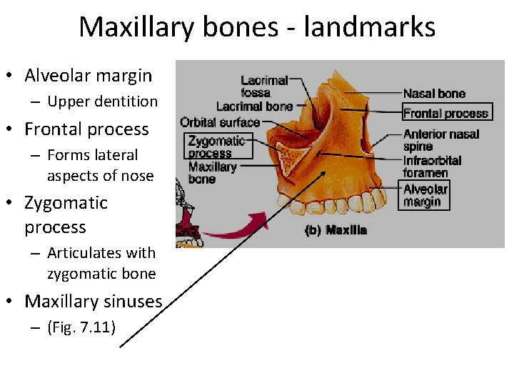 Maxillary bones - landmarks • Alveolar margin – Upper dentition • Frontal process –