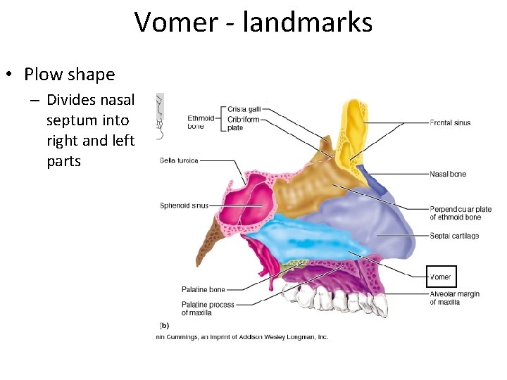 Vomer - landmarks • Plow shape – Divides nasal septum into right and left