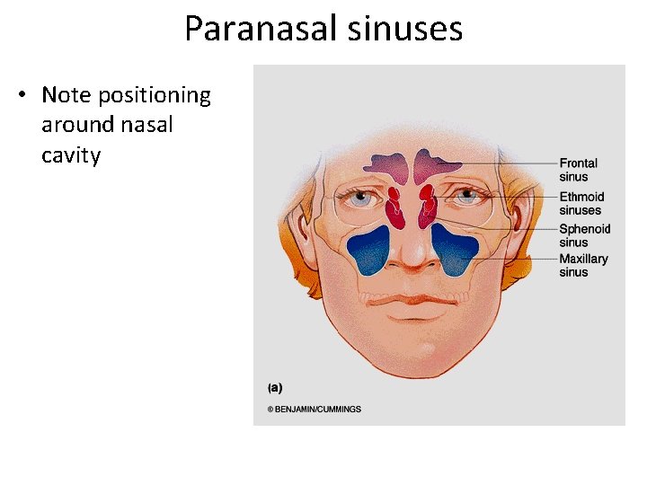 Paranasal sinuses • Note positioning around nasal cavity 
