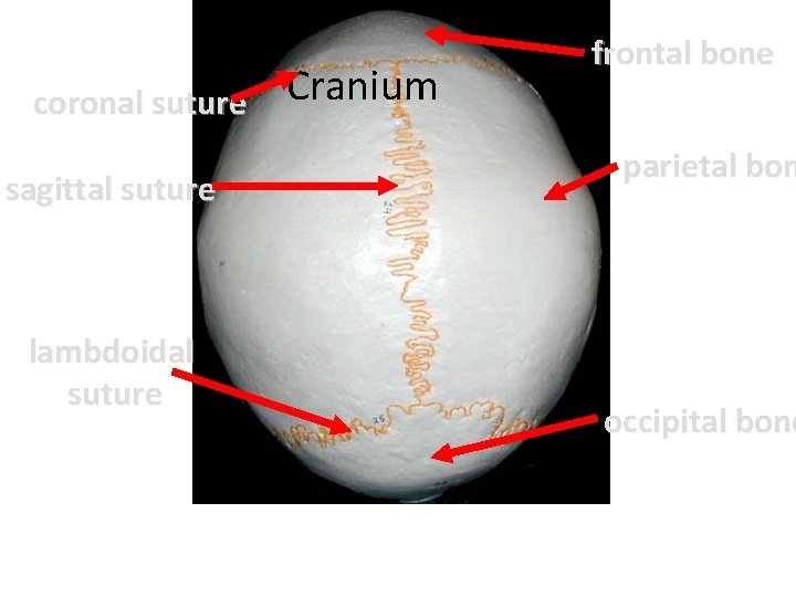 coronal suture sagittal suture lambdoidal suture Cranium frontal bone parietal bon occipital bone 