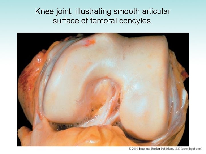 Knee joint, illustrating smooth articular surface of femoral condyles. 