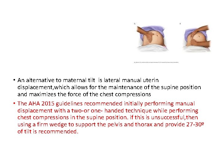  • An alternative to maternal tilt is lateral manual uterin displacement, which allows