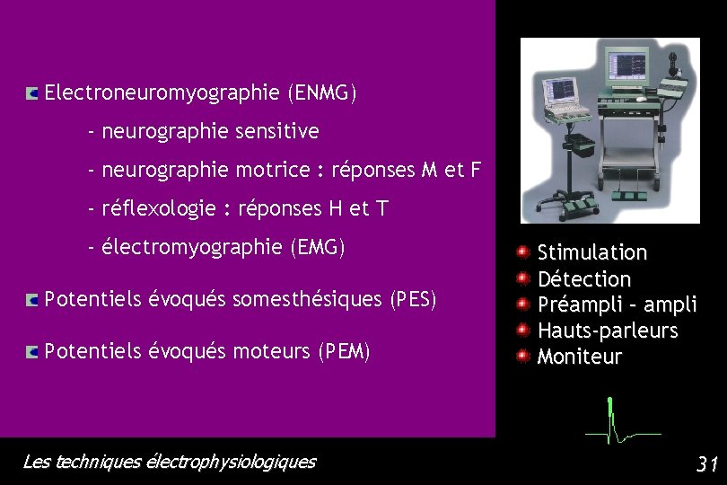 Electroneuromyographie (ENMG) - neurographie sensitive - neurographie motrice : réponses M et F -