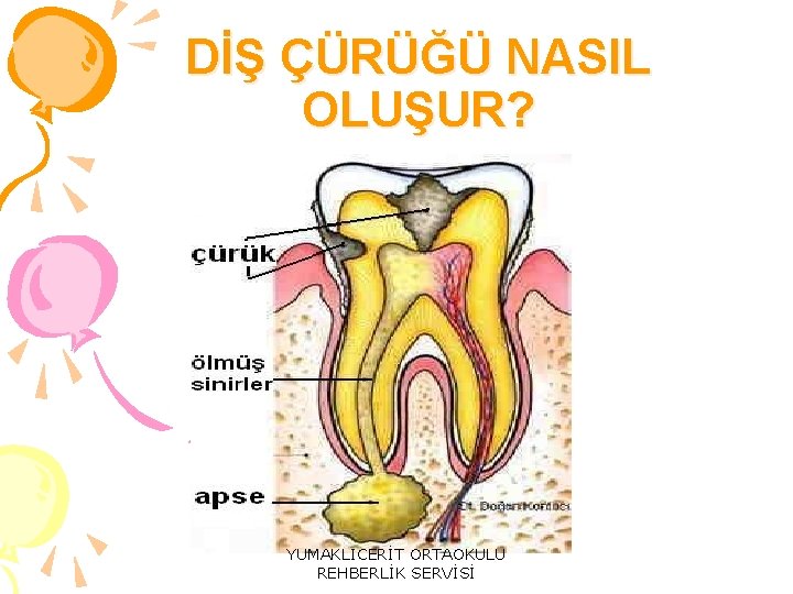 DİŞ ÇÜRÜĞÜ NASIL OLUŞUR? YUMAKLICERİT ORTAOKULU REHBERLİK SERVİSİ 