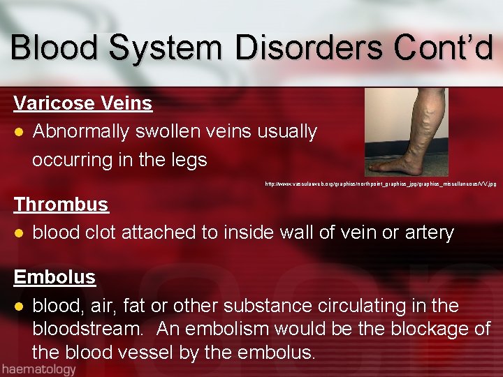 Blood System Disorders Cont’d Varicose Veins Abnormally swollen veins usually occurring in the legs