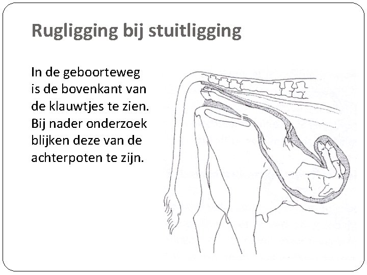 Rugligging bij stuitligging In de geboorteweg is de bovenkant van de klauwtjes te zien.