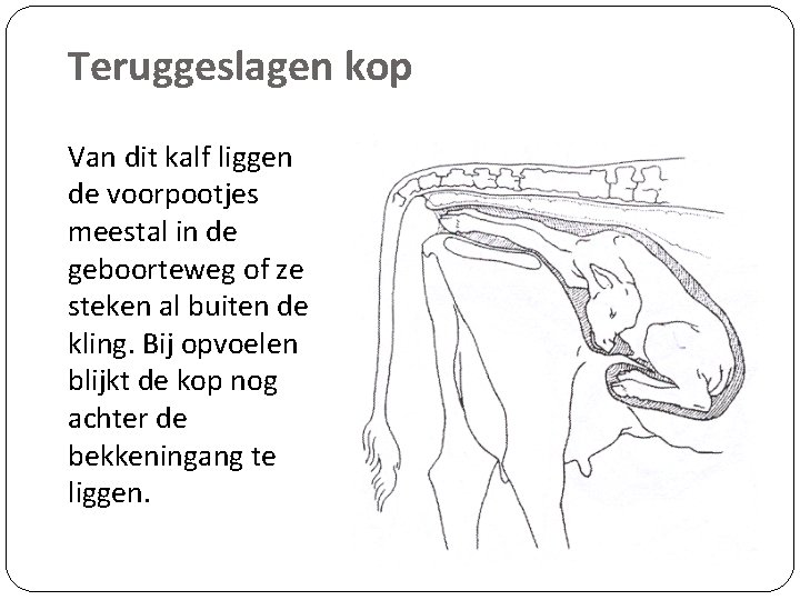 Teruggeslagen kop Van dit kalf liggen de voorpootjes meestal in de geboorteweg of ze