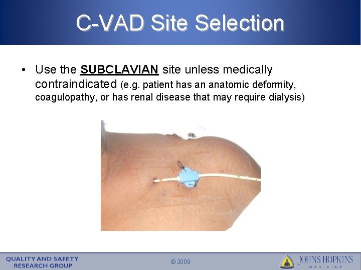 C-VAD Site Selection • Use the SUBCLAVIAN site unless medically contraindicated (e. g. patient