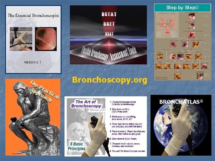 Step by Step© Bronchoscopy. org BRONCHATLAS© BI 21 