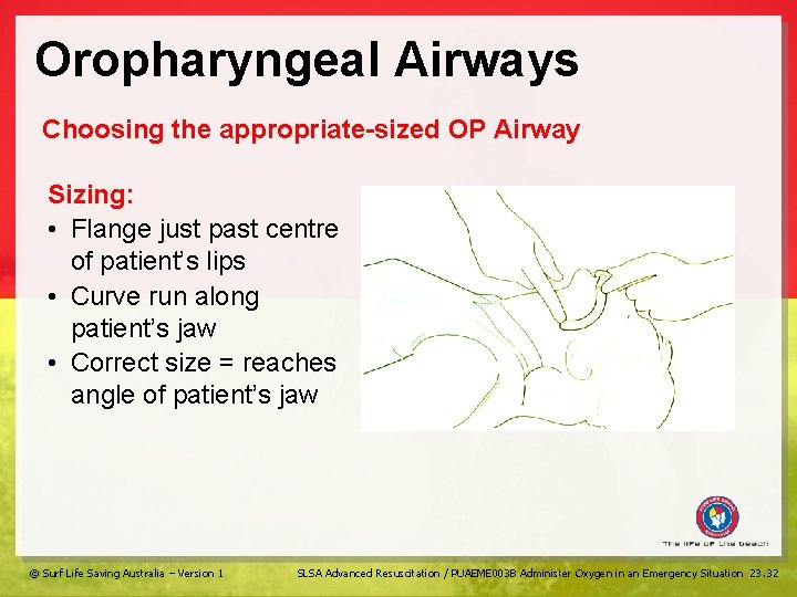 Oropharyngeal Airways Choosing the appropriate-sized OP Airway Sizing: • Flange just past centre of