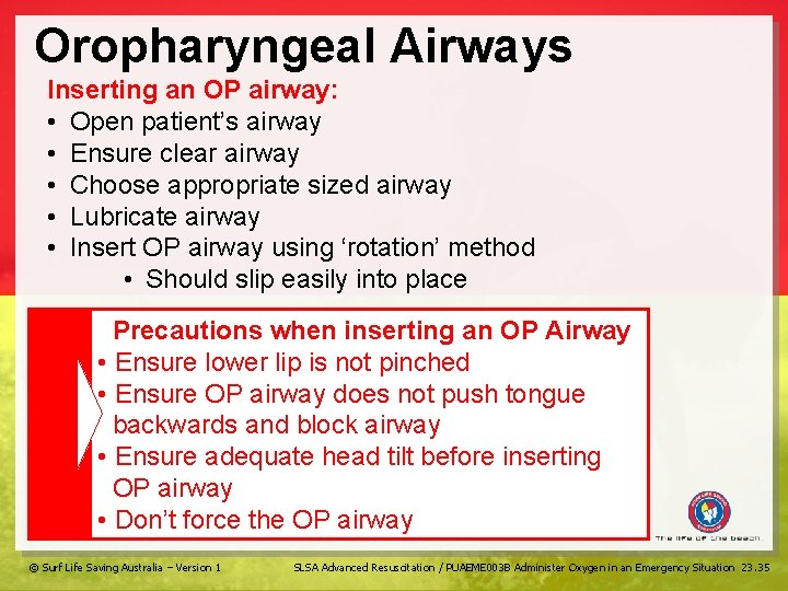 Oropharyngeal Airways Inserting an OP airway: • Open patient’s airway • Ensure clear airway