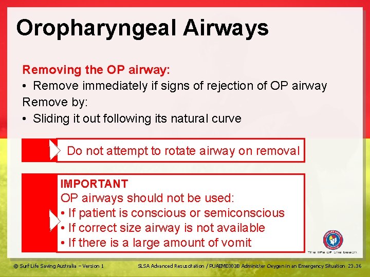 Oropharyngeal Airways Removing the OP airway: • Remove immediately if signs of rejection of