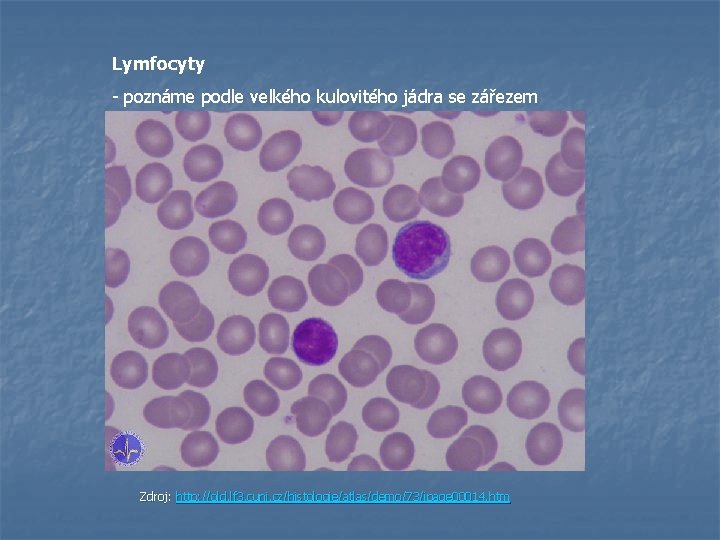 Lymfocyty - poznáme podle velkého kulovitého jádra se zářezem Zdroj: http: //old. lf 3.