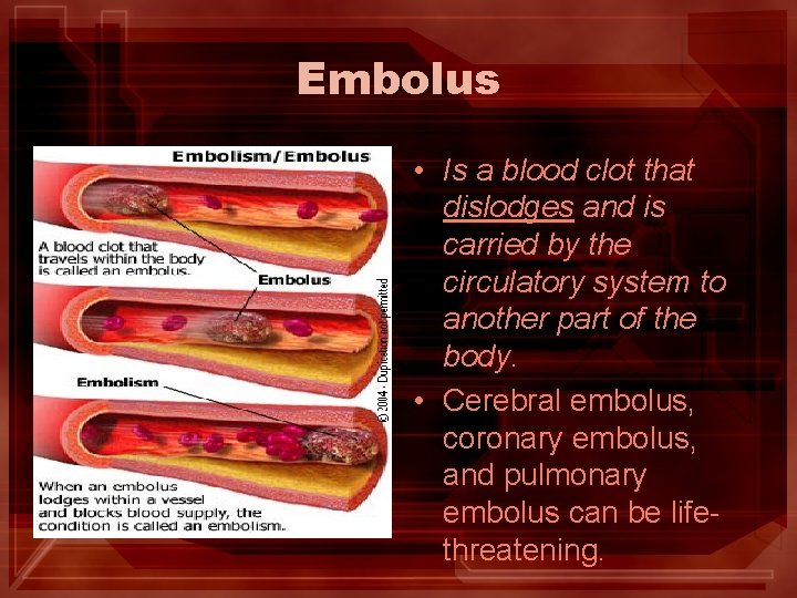 Embolus • Is a blood clot that dislodges and is carried by the circulatory Embolus • Is a blood clot that dislodges and is carried by the circulatory