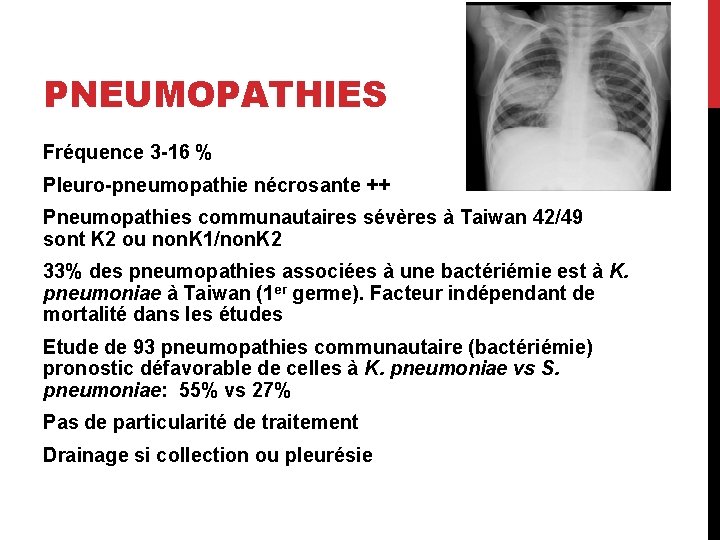 PNEUMOPATHIES Fréquence 3 -16 % Pleuro-pneumopathie nécrosante ++ Pneumopathies communautaires sévères à Taiwan 42/49