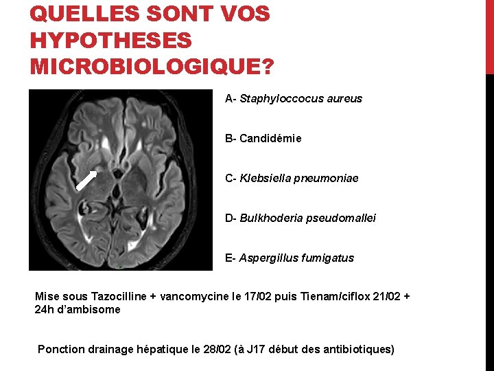 QUELLES SONT VOS HYPOTHESES MICROBIOLOGIQUE? A- Staphyloccocus aureus B- Candidémie C- Klebsiella pneumoniae D-