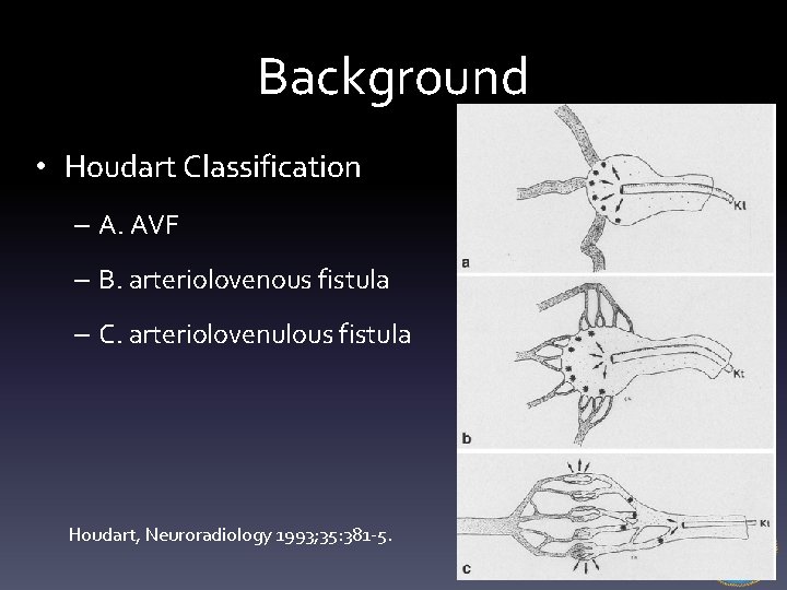 Background • Houdart Classification – A. AVF – B. arteriolovenous fistula – C. arteriolovenulous