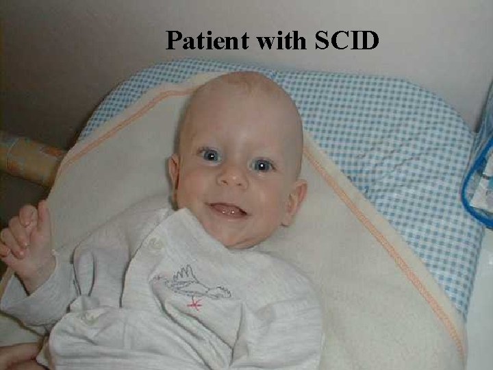 Patient with SCID Patient with SCID