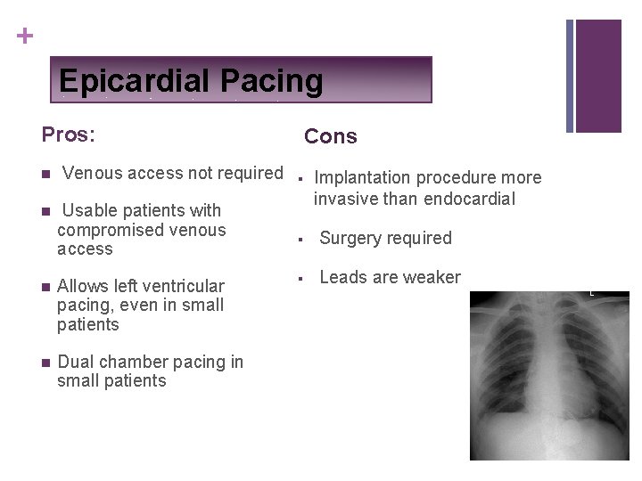 + Epicardial Pacing Pros: n n Venous access not required Usable patients with compromised