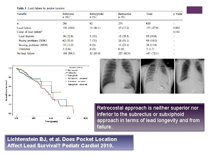 Retrocostal approach is neither superior nor inferior to the subrectus or subxiphoid approach in