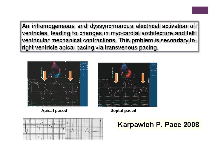 An inhomogeneous and dyssynchronous electrical activation of ventricles, leading to changes in myocardial architecture