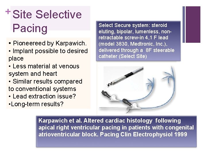 + Site Selective Pacing • Pioneereed by Karpawich. • Implant possible to desired place