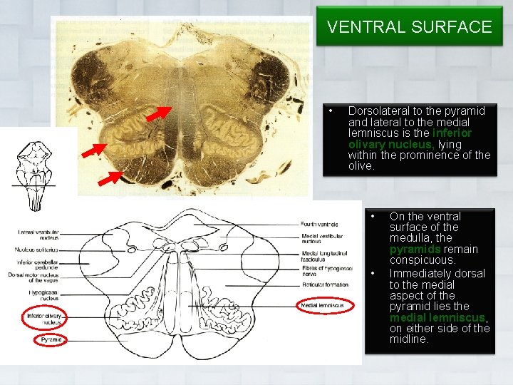 VENTRAL SURFACE • Dorsolateral to the pyramid and lateral to the medial lemniscus is
