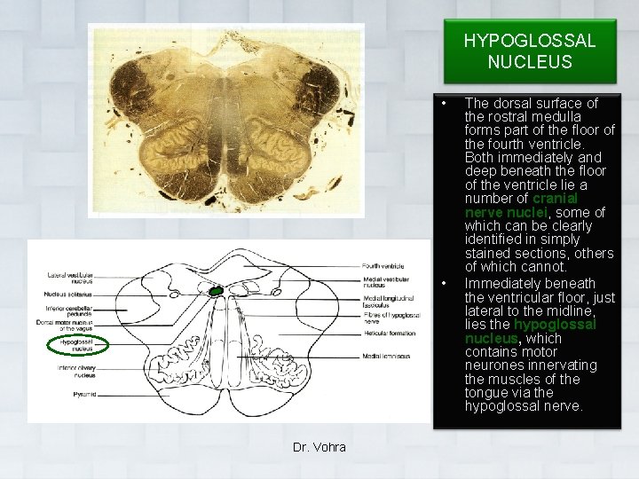 HYPOGLOSSAL NUCLEUS • • Dr. Vohra The dorsal surface of the rostral medulla forms