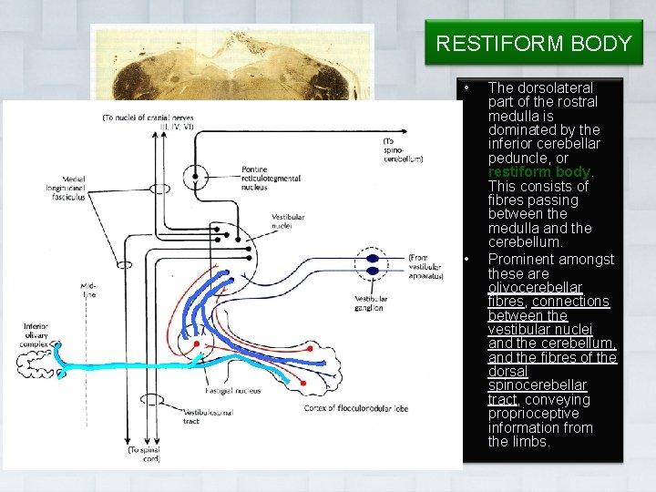 RESTIFORM BODY • • Dr. Vohra The dorsolateral part of the rostral medulla is