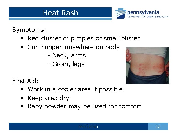 Heat Rash Symptoms: § Red cluster of pimples or small blister § Can happen