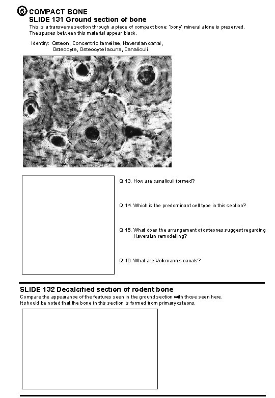 5 COMPACT BONE SLIDE 131 Ground section of bone This is a transverse section