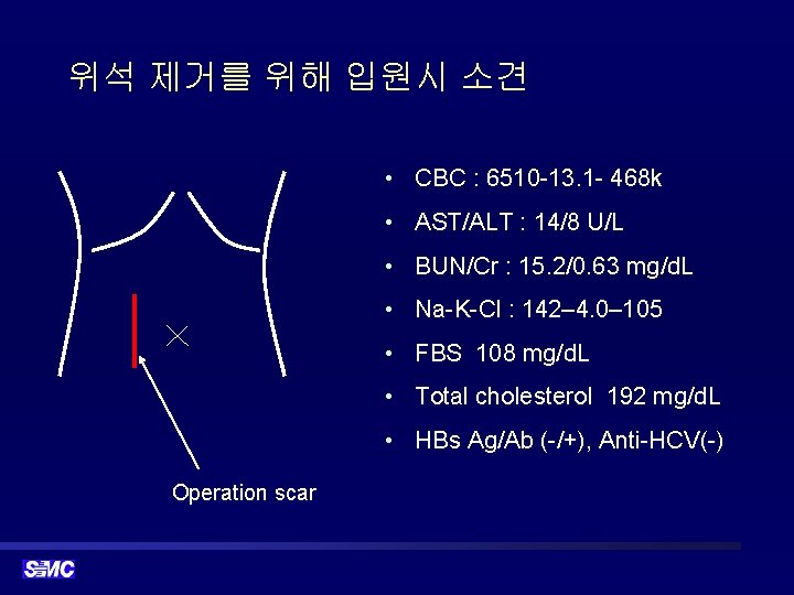 위석 제거를 위해 입원시 소견 • CBC : 6510 -13. 1 - 468 k