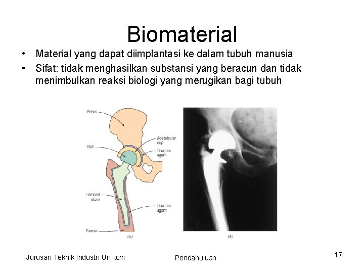 Biomaterial • Material yang dapat diimplantasi ke dalam tubuh manusia • Sifat: tidak menghasilkan