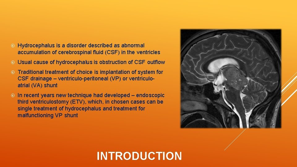  Hydrocephalus is a disorder described as abnormal accumulation of cerebrospinal fluid (CSF) in