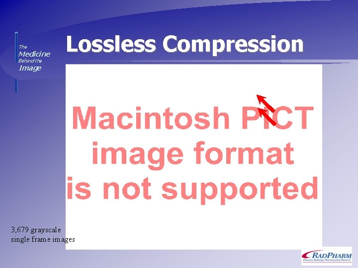 The Medicine Lossless Compression Behind the Image 3, 679 grayscale single frame images 