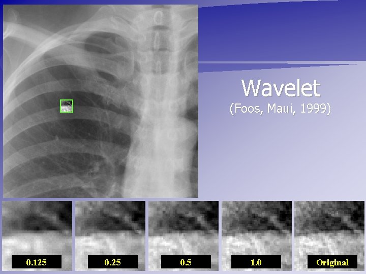 The Medicine Behind the Image Wavelet (Foos, Maui, 1999) 0. 125 0. 5 1.