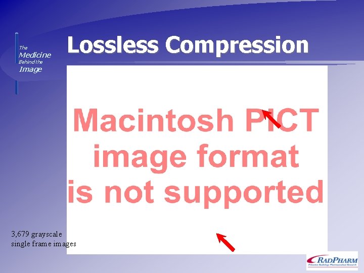 The Medicine Lossless Compression Behind the Image 3, 679 grayscale single frame images 