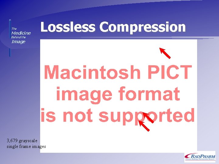 The Medicine Lossless Compression Behind the Image 3, 679 grayscale single frame images 