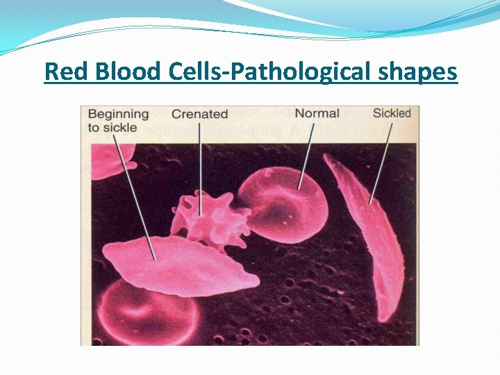  Red Blood Cells-Pathological shapes 